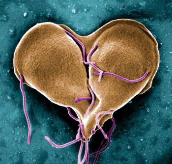 Imagen: Una microfotografía electrónica de barrido (SEM) del parásito intestinal, Giardia lamblia (Fotografía cortesía del Dr. Stan Erlandsen).